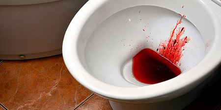 初期血尿没注意 最后确诊为膀胱癌末 家里这四种物质最易染癌|每日